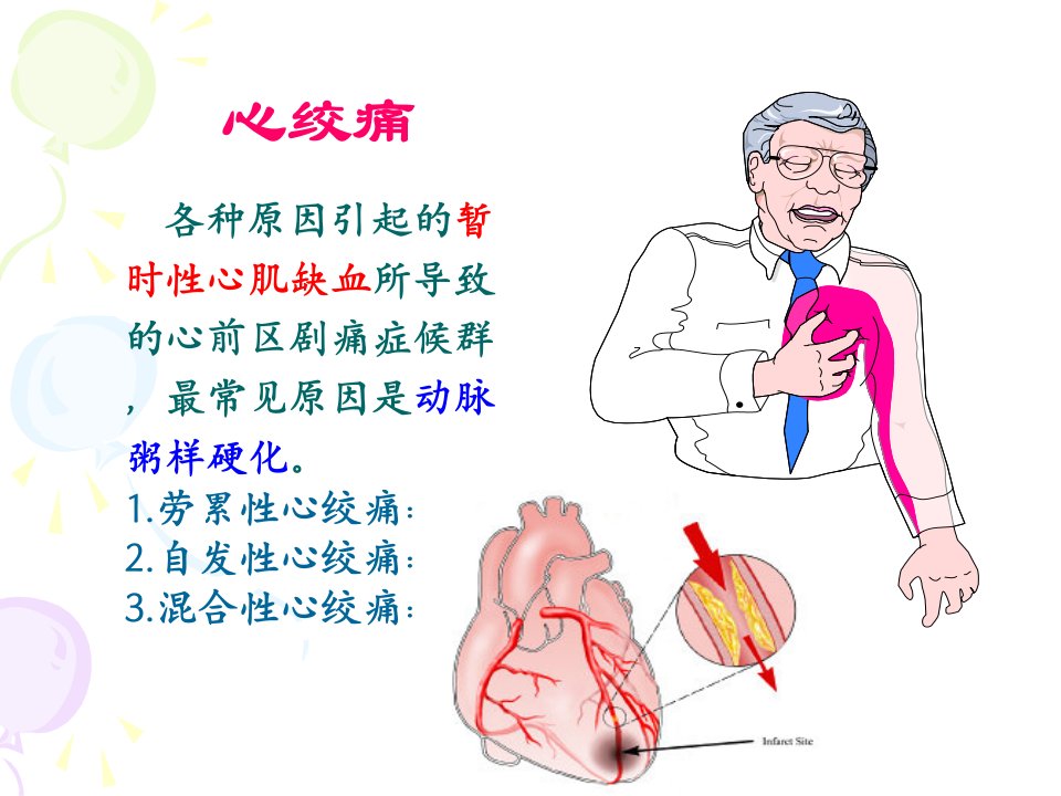 抗心绞痛药