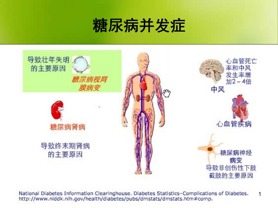 糖尿病并发症的预防与治疗ppt课件