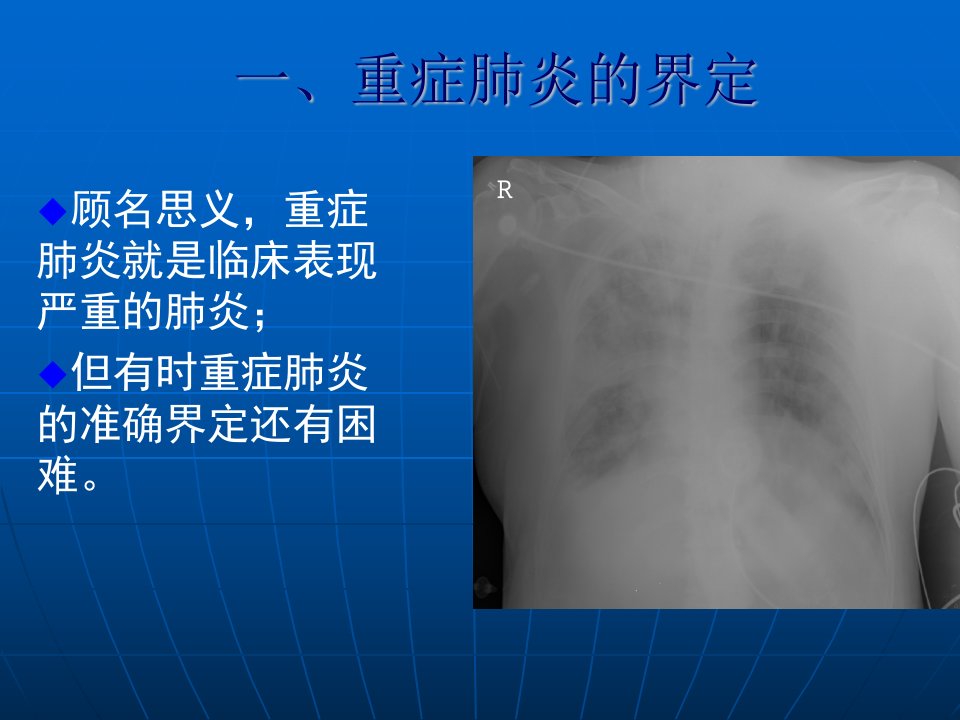 重症肺炎的诊治orignal(2)