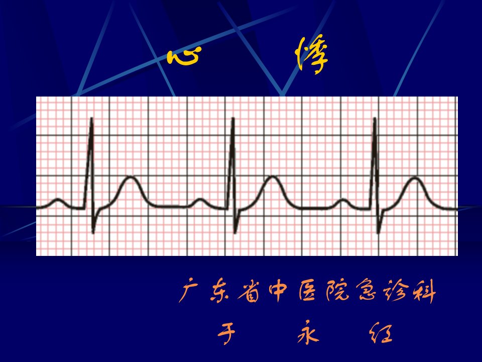 中医急诊学心悸教案