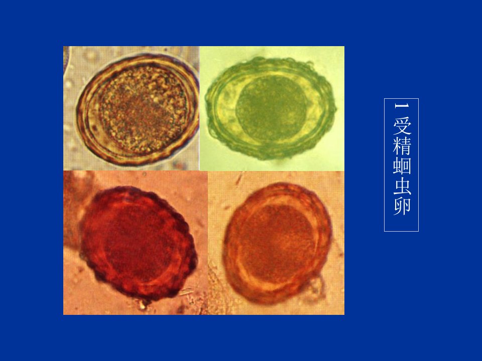 人体寄生虫学标本复习