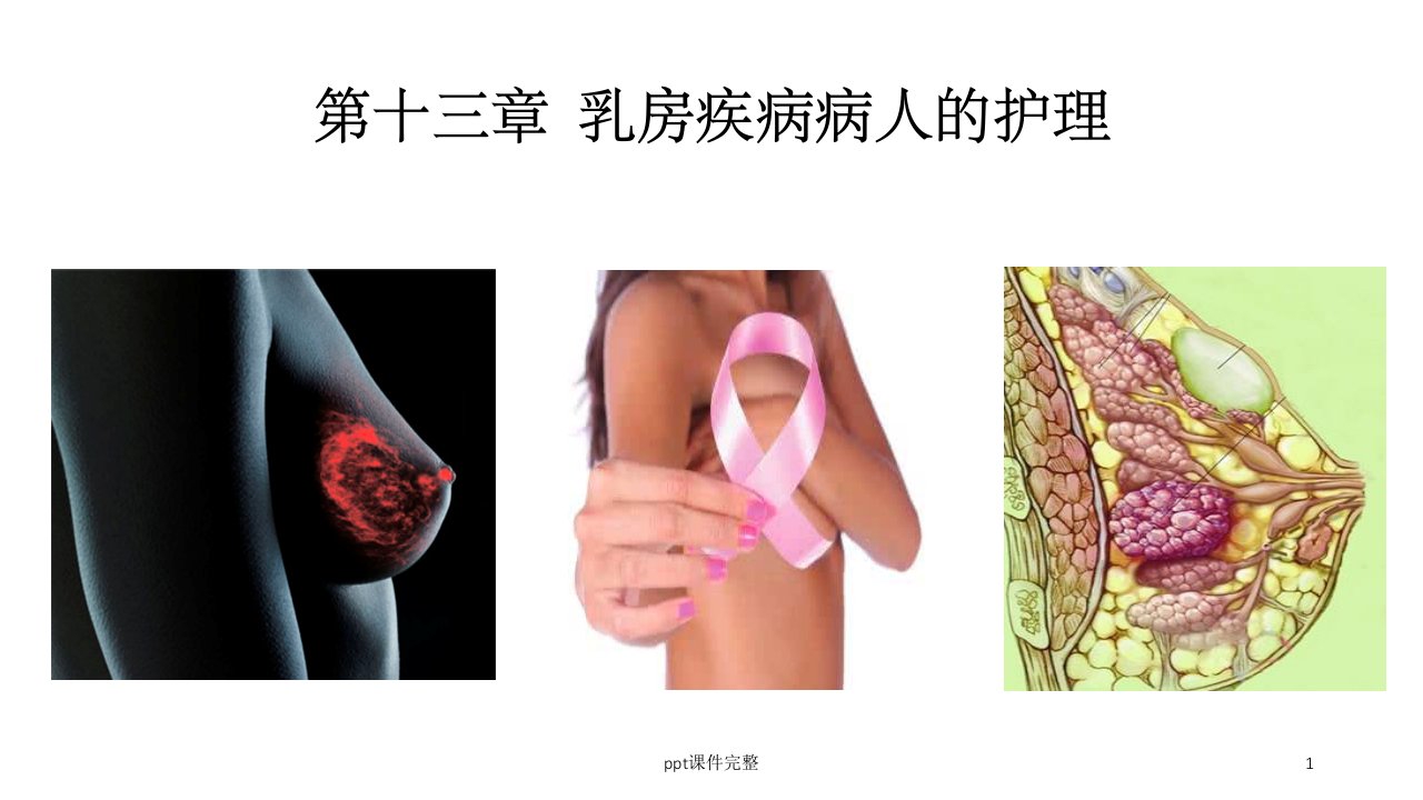 乳房疾病病人的护理PPT课件