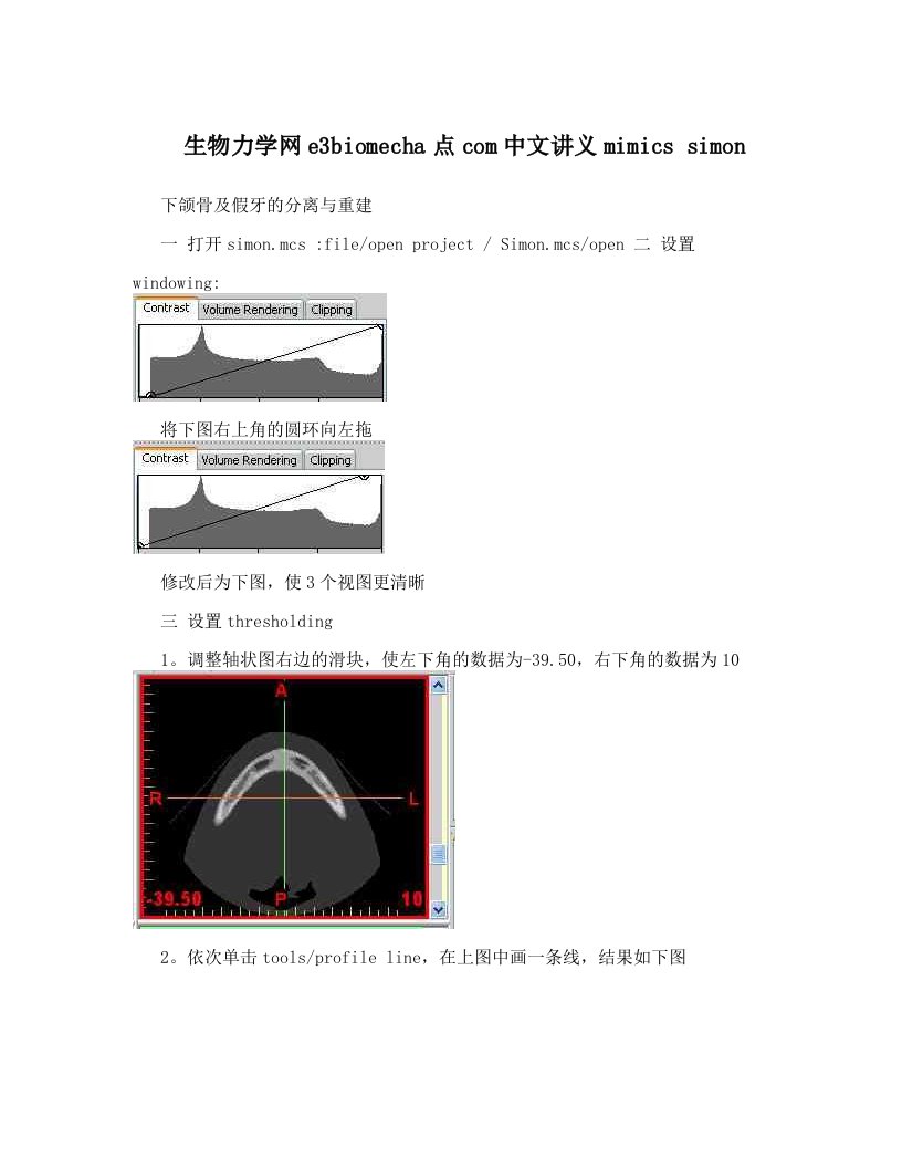 wguAAA生物力学网e3biomecha点com中文讲义mimics+simon