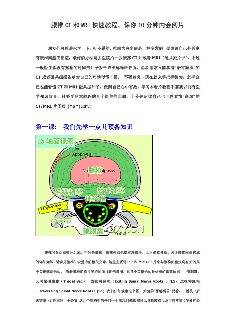 腰椎CT和MRI快速教程_保你10分钟内会阅片