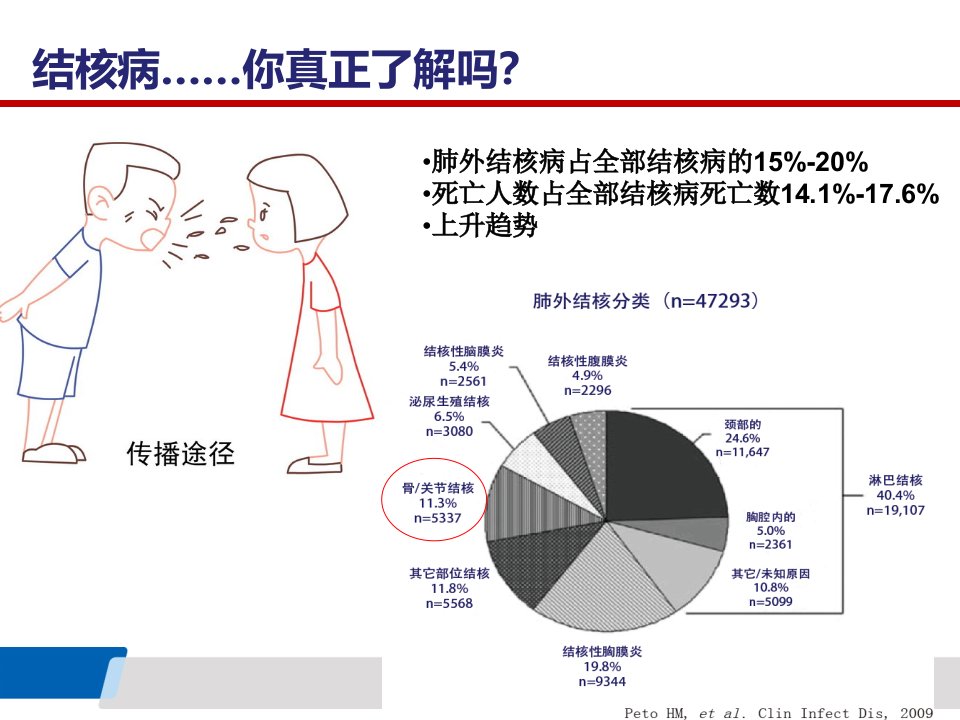 骨科结核感染T细胞斑点检测SPOT