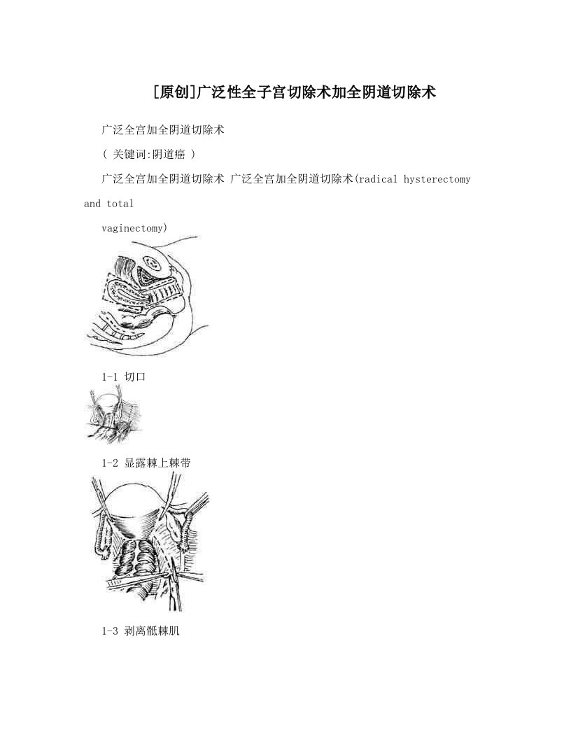 [原创]广泛性全子宫切除术加全阴道切除术