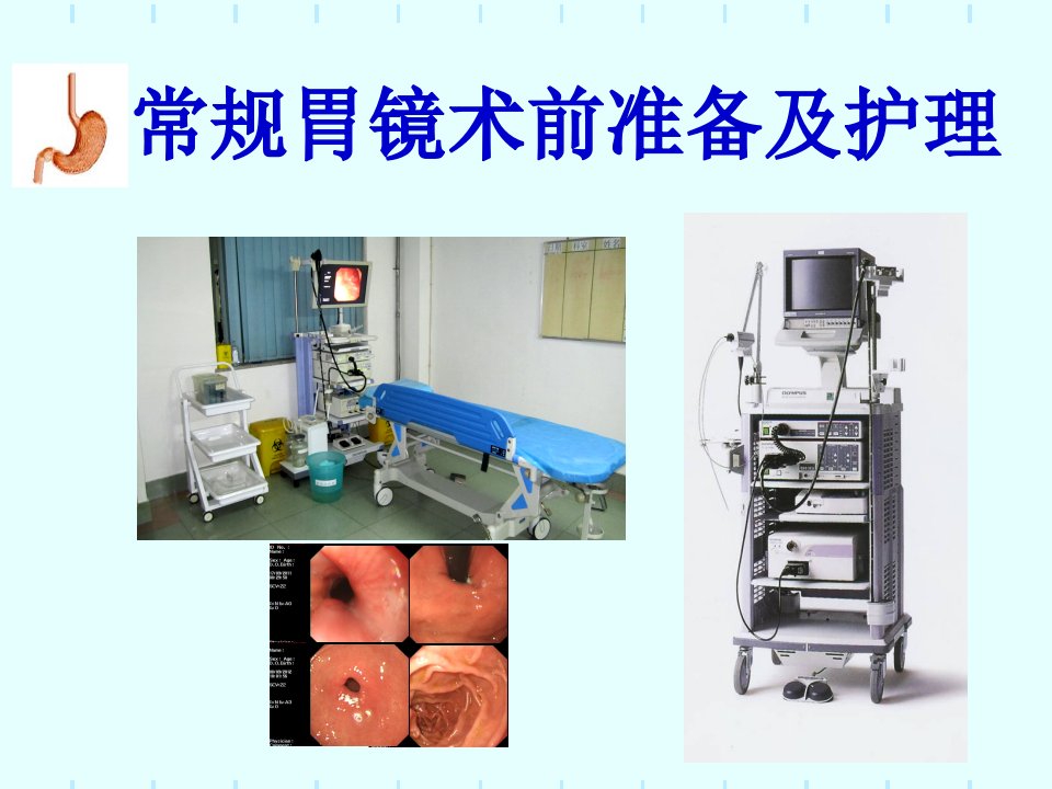 常规胃镜术前准备及护理