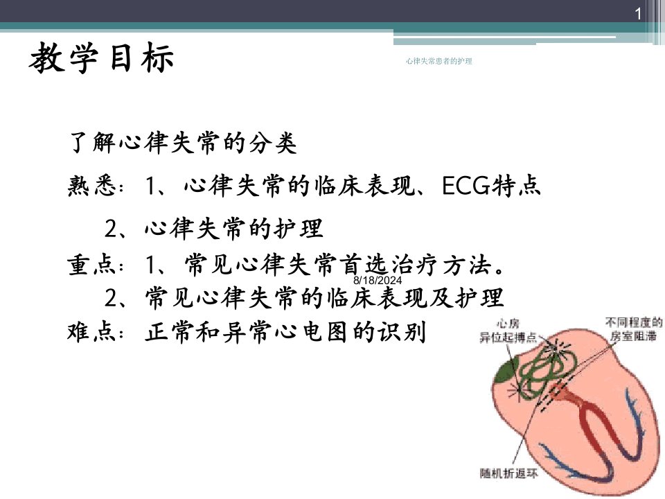 2021年心律失常患者的护理