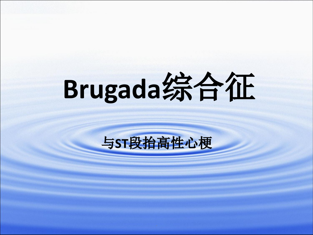 Brugada综合征ppt课件