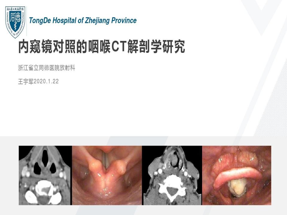 内窥镜对照的咽喉CT解剖学研究