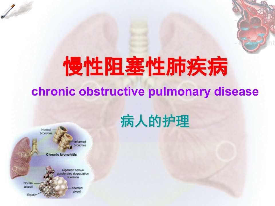 COPD病人的护理幻灯片