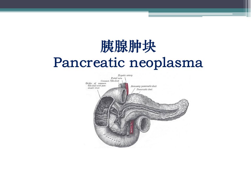 胰腺肿瘤.ppt