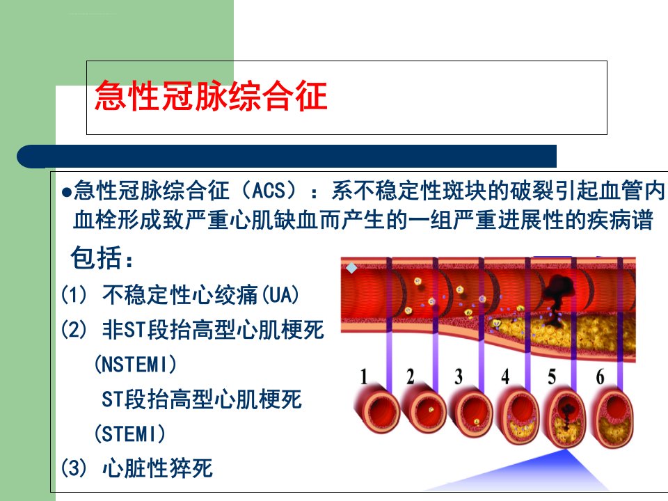 急性冠脉综合征的抗血小板治疗新进展PPT课件