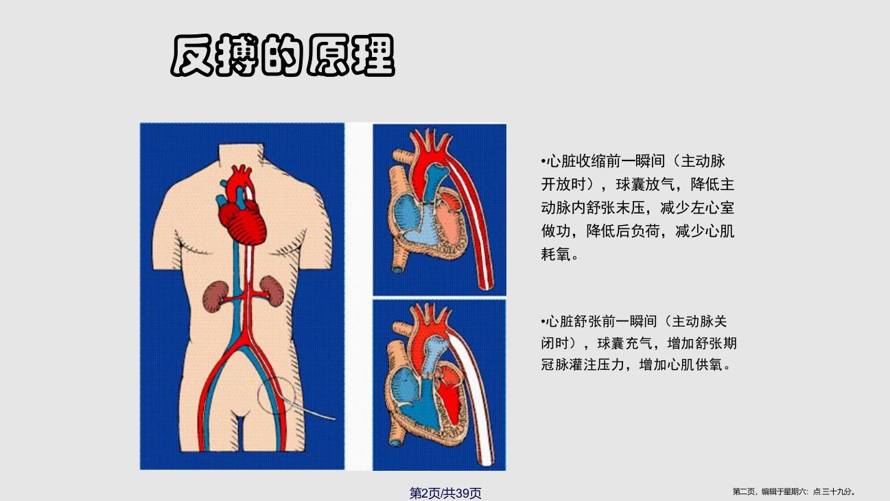 IABP概述学习教程