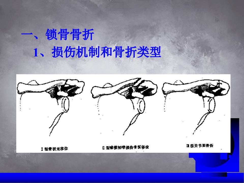 乡村常见病之骨科课件