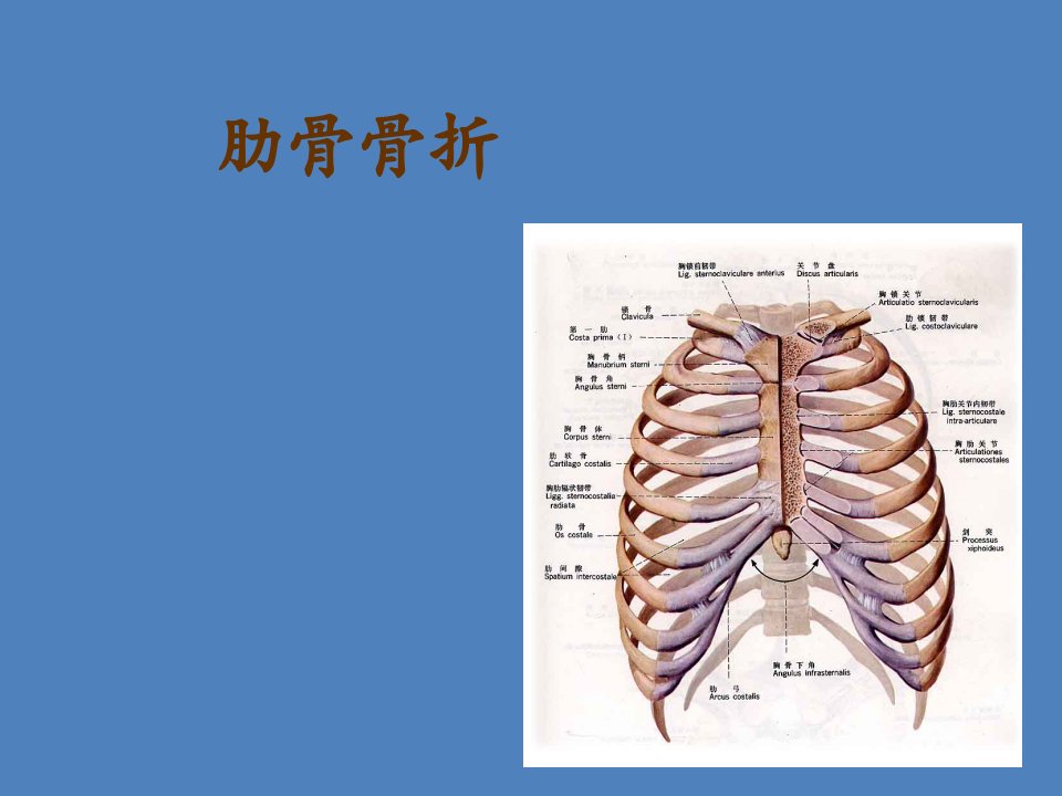 肋骨骨折的护理