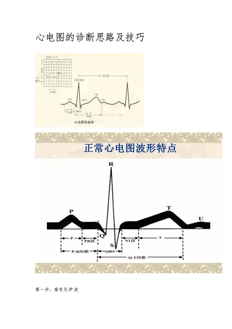 心电图的诊断思路及技巧