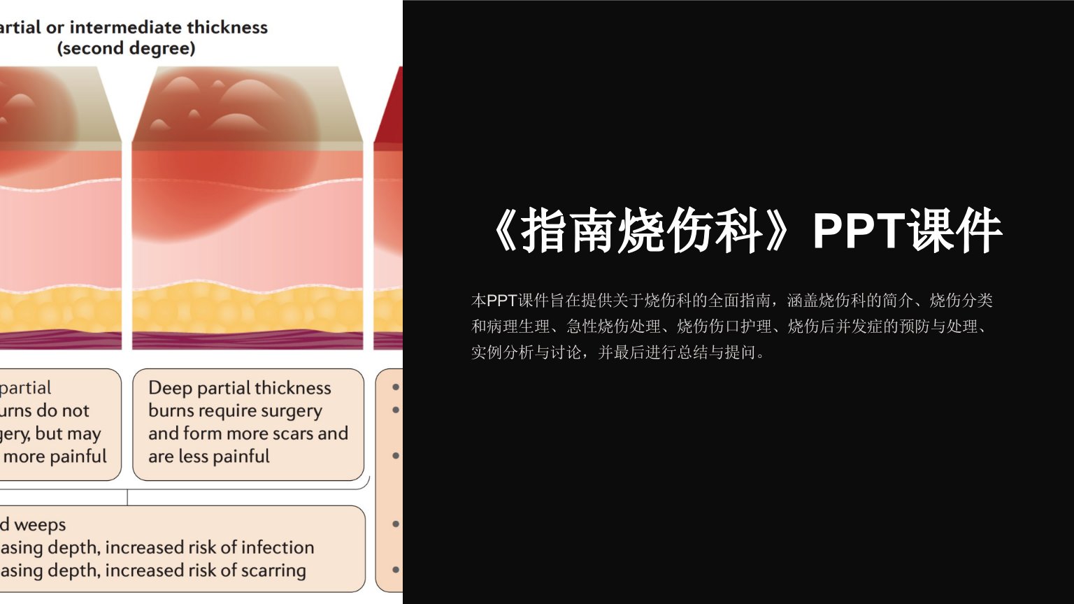 《指南烧伤科》课件