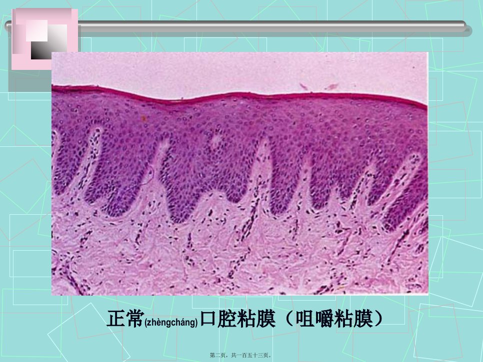 医学专题口腔粘膜病全