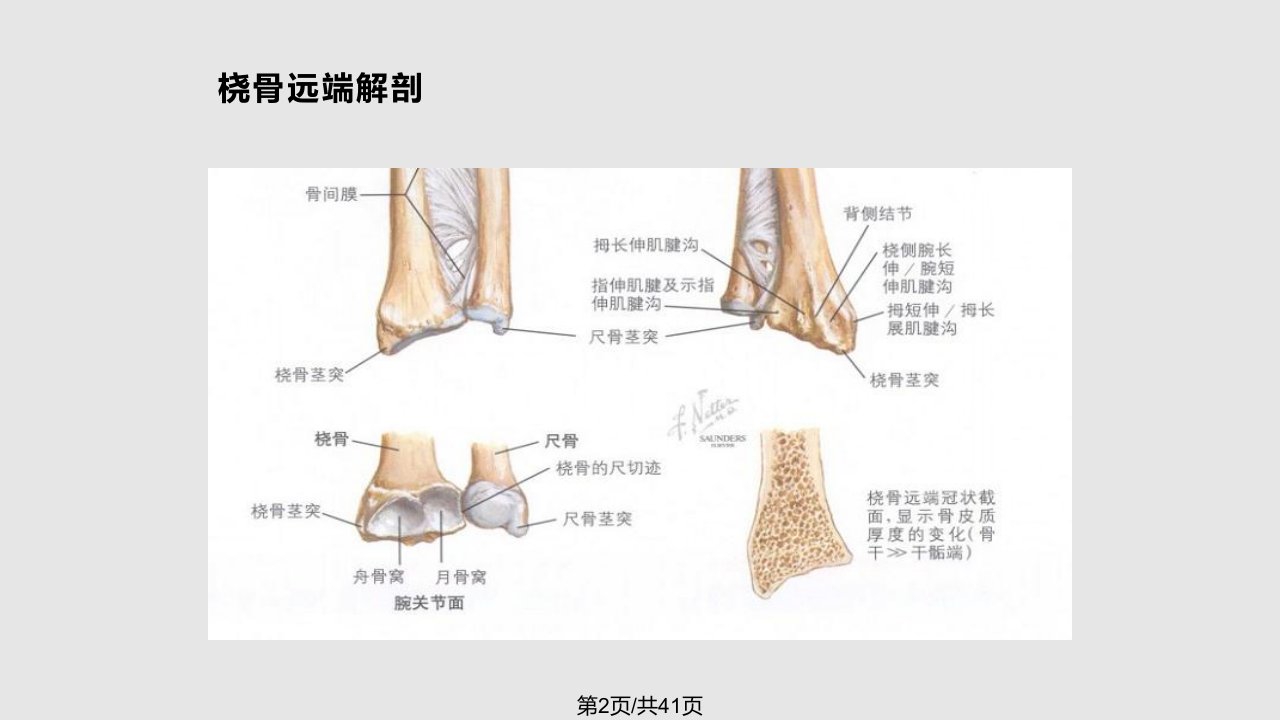 掌背侧钢板治疗桡骨远端骨折