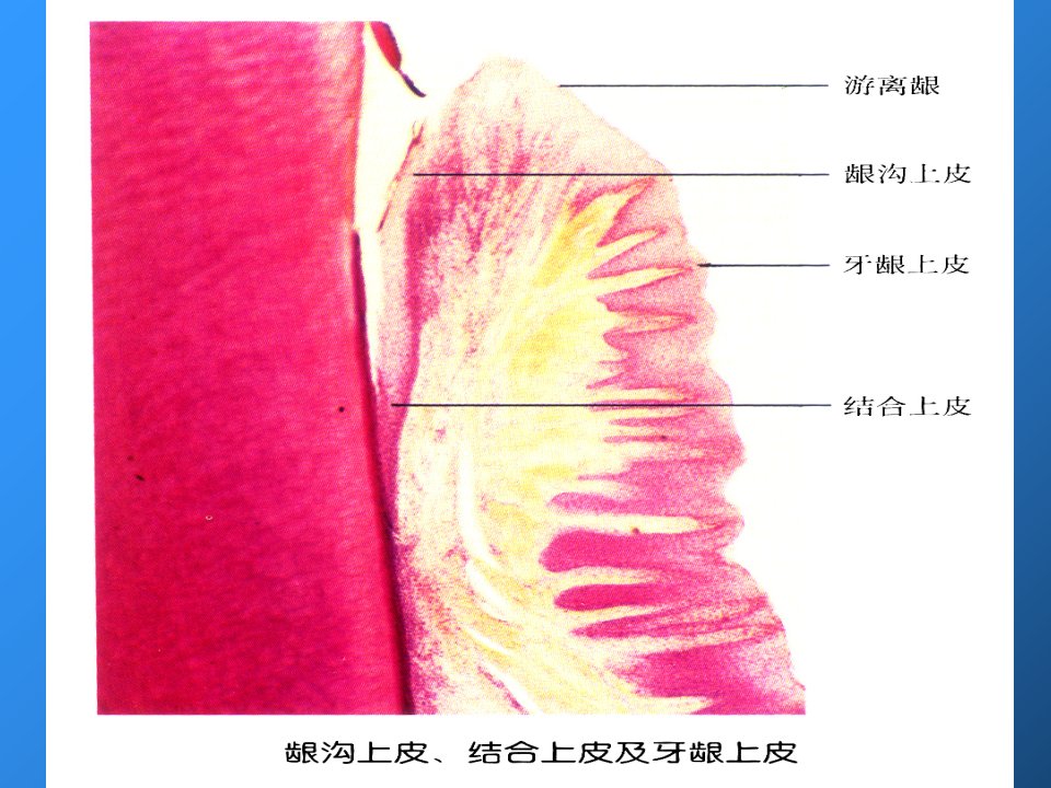 教学课件第5章牙周和粘膜常见病