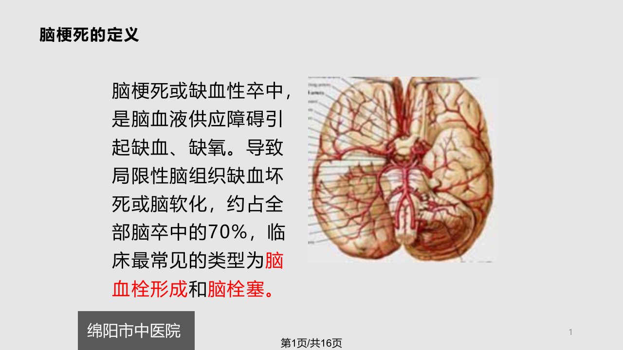 脑梗死患者的心理护理课件