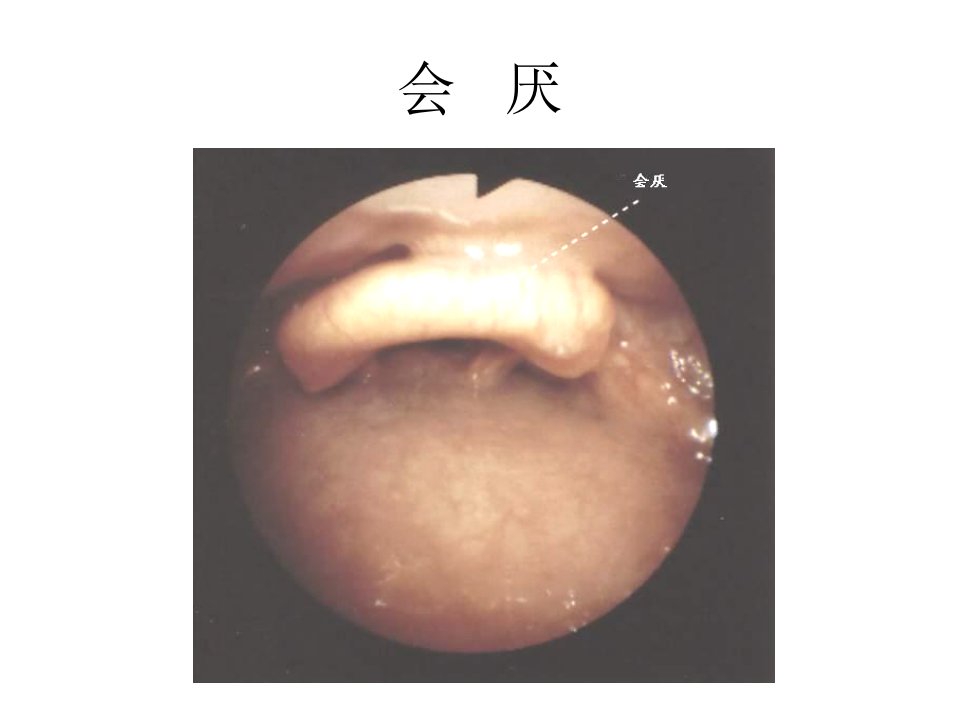 纤支镜的临床图谱