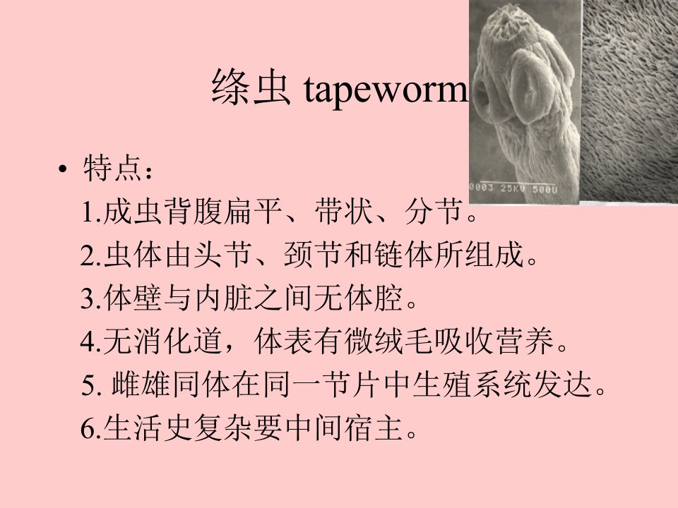 绦虫tapeworm