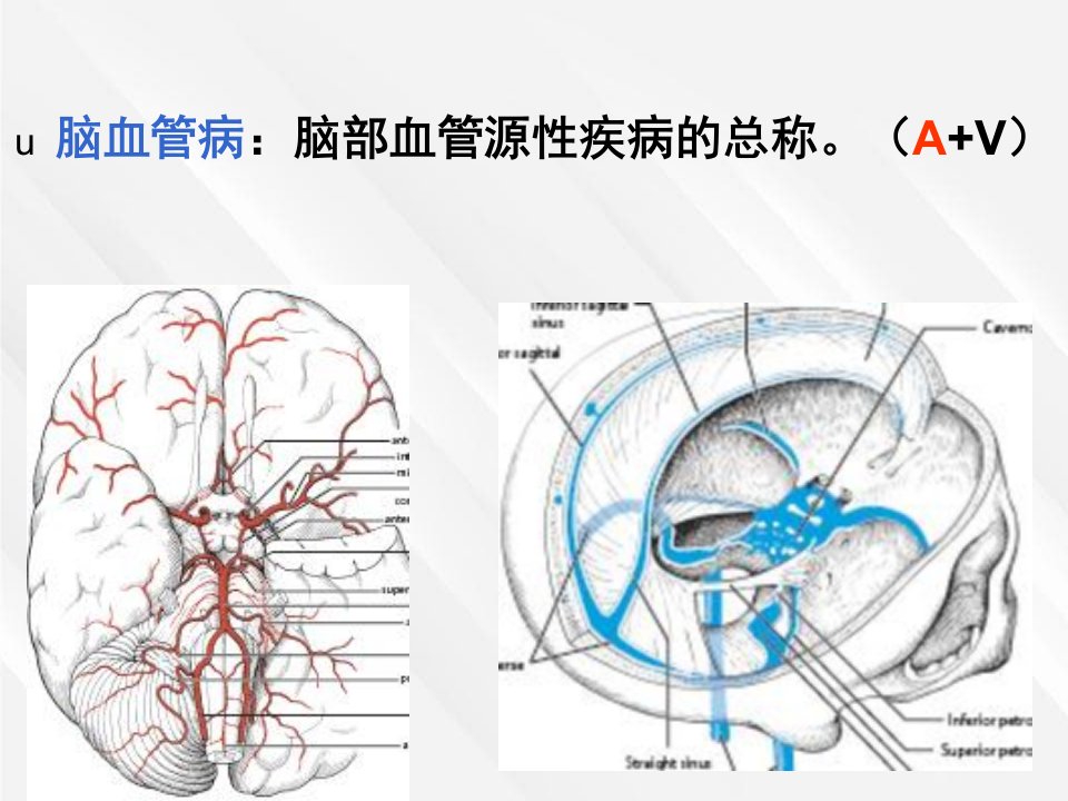 临床医学课件脑中风与康复