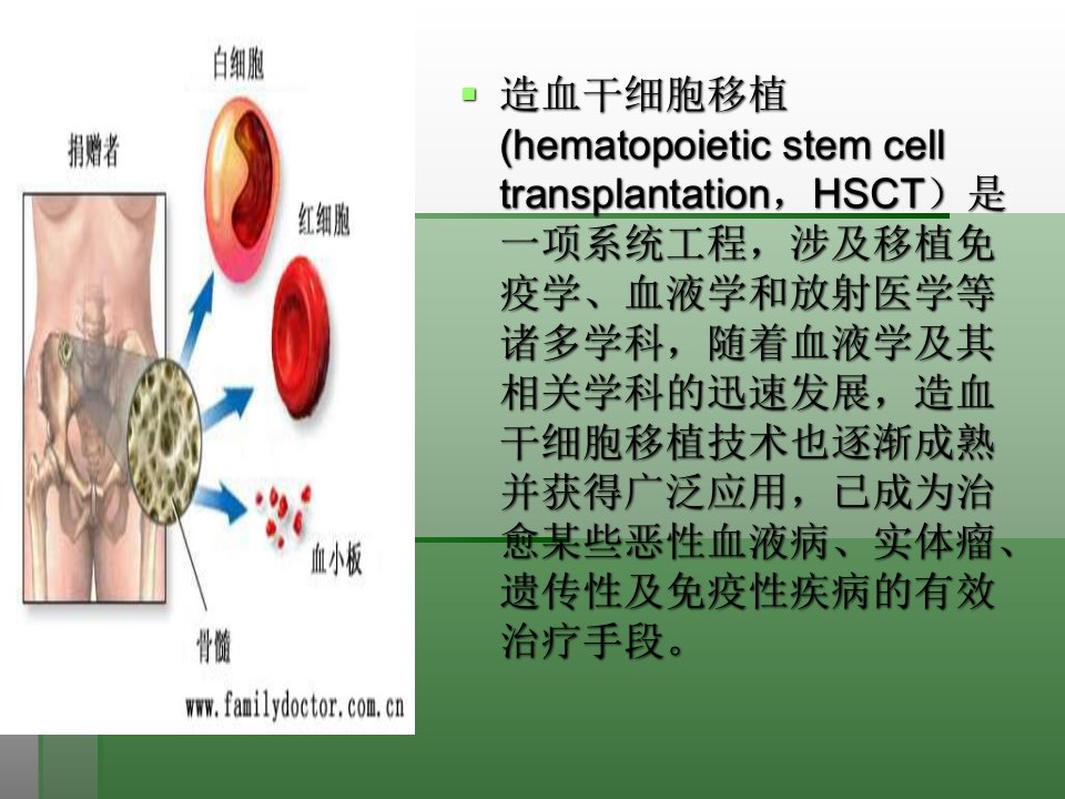 外周血干细胞移植