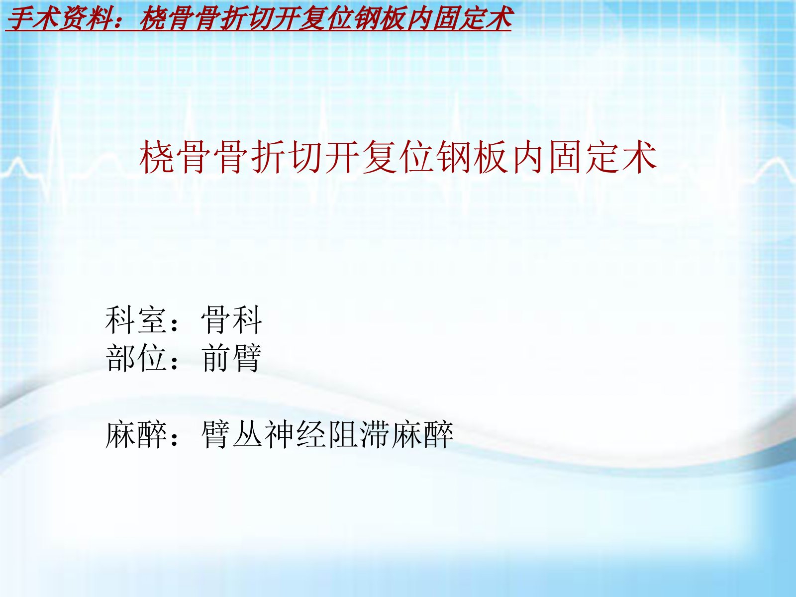 手术讲解模板桡骨骨折切开复位钢板内固定术ppt课件