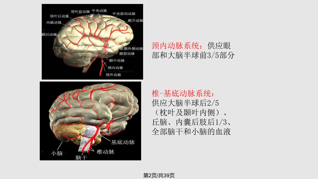 脑梗塞的护理查房12