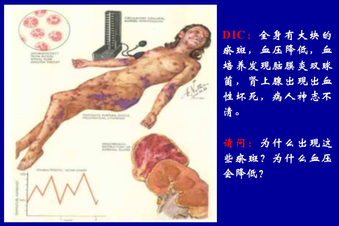 病理生理学绪论疾病概论课件