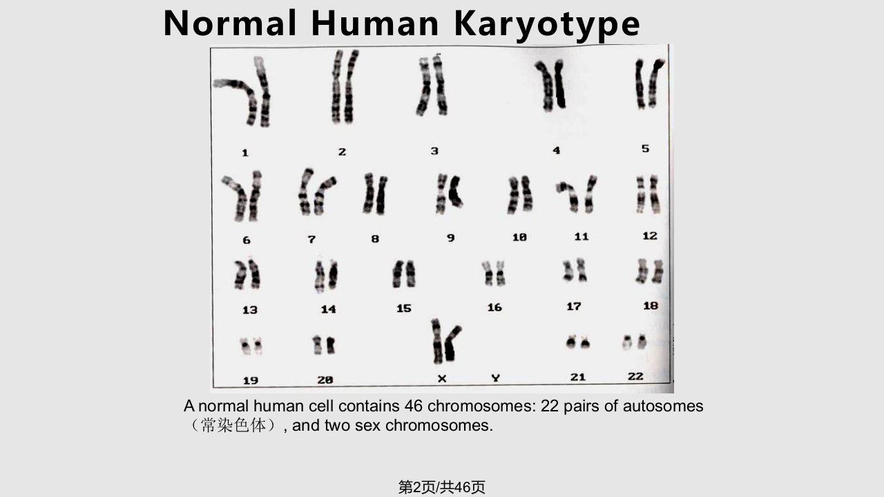 染色体畸变结构改变