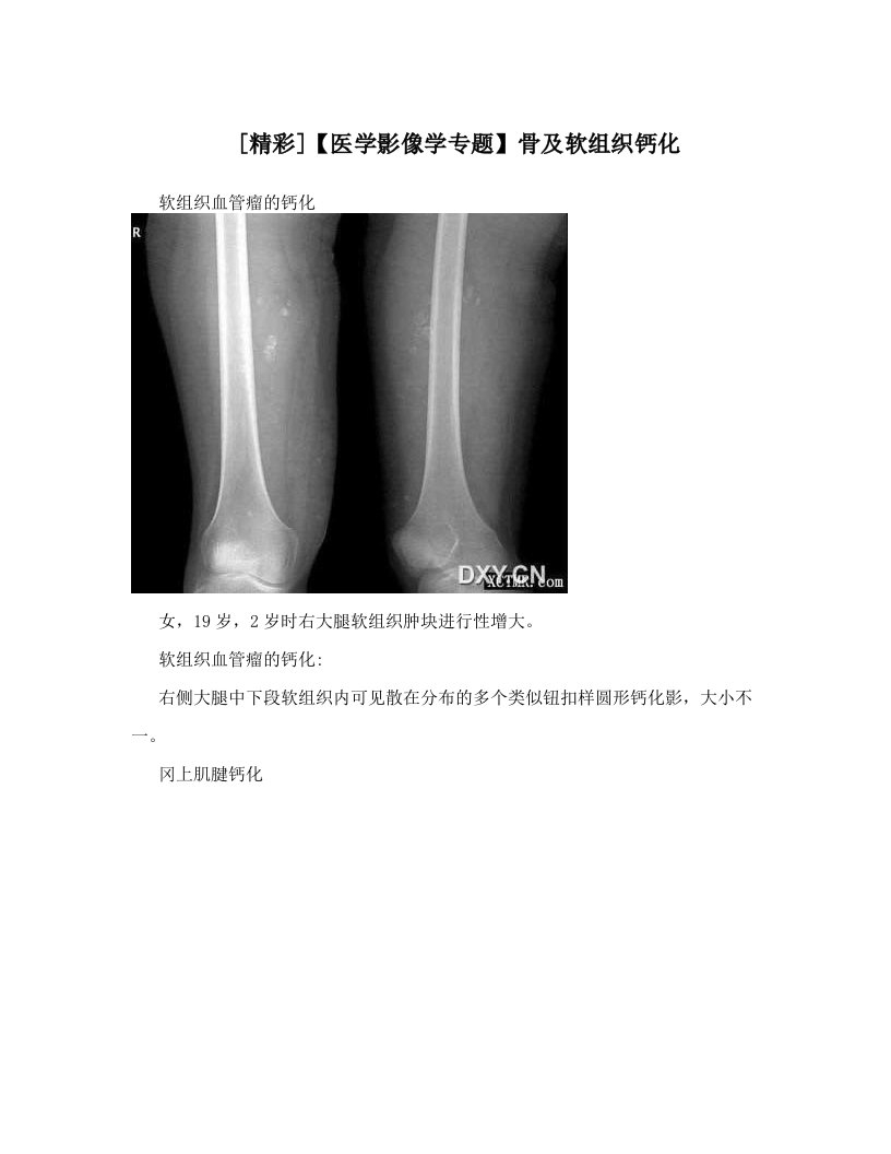 [精彩]【医学影像学专题】骨及软组织钙化