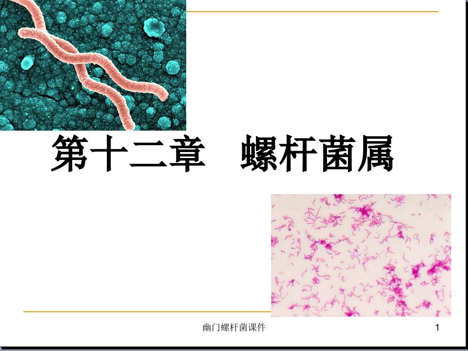 幽门螺杆菌ppt课件