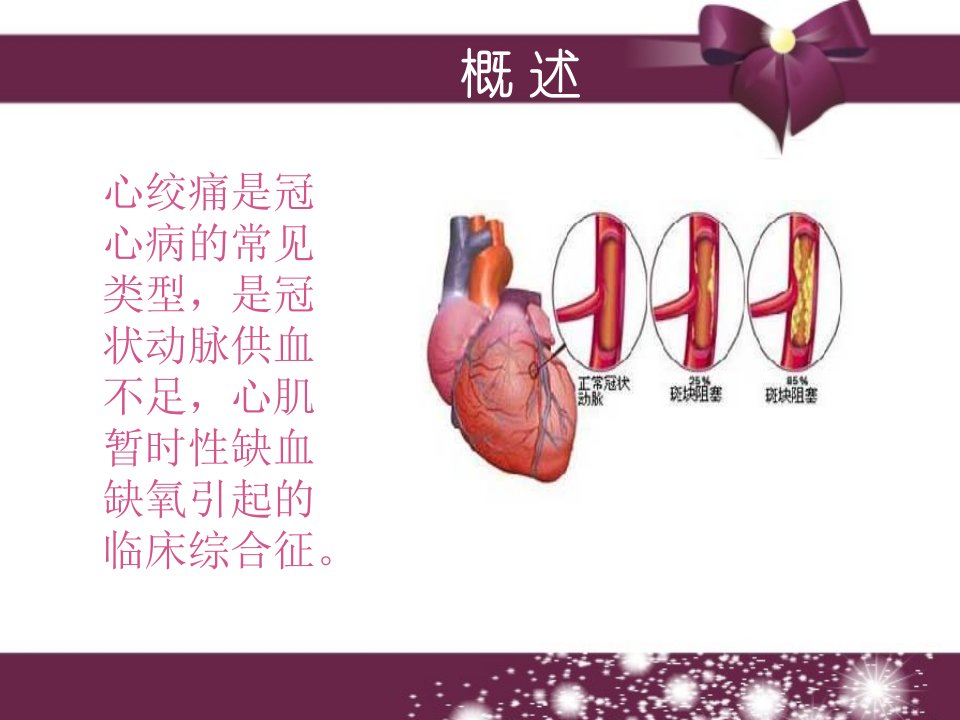 心绞痛患者的健康教育ppt课件