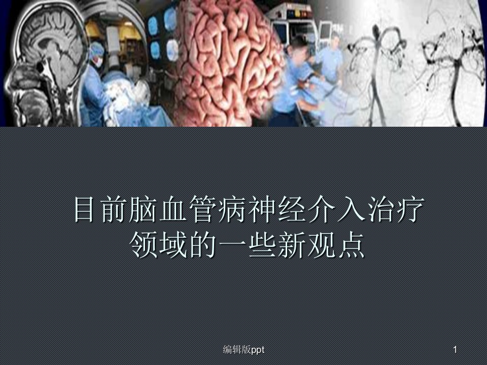 目前脑血管病神经介入治疗ppt课件