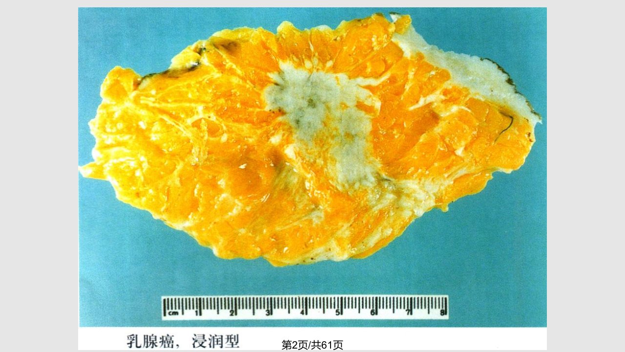 肿瘤生化与分子生物学基础