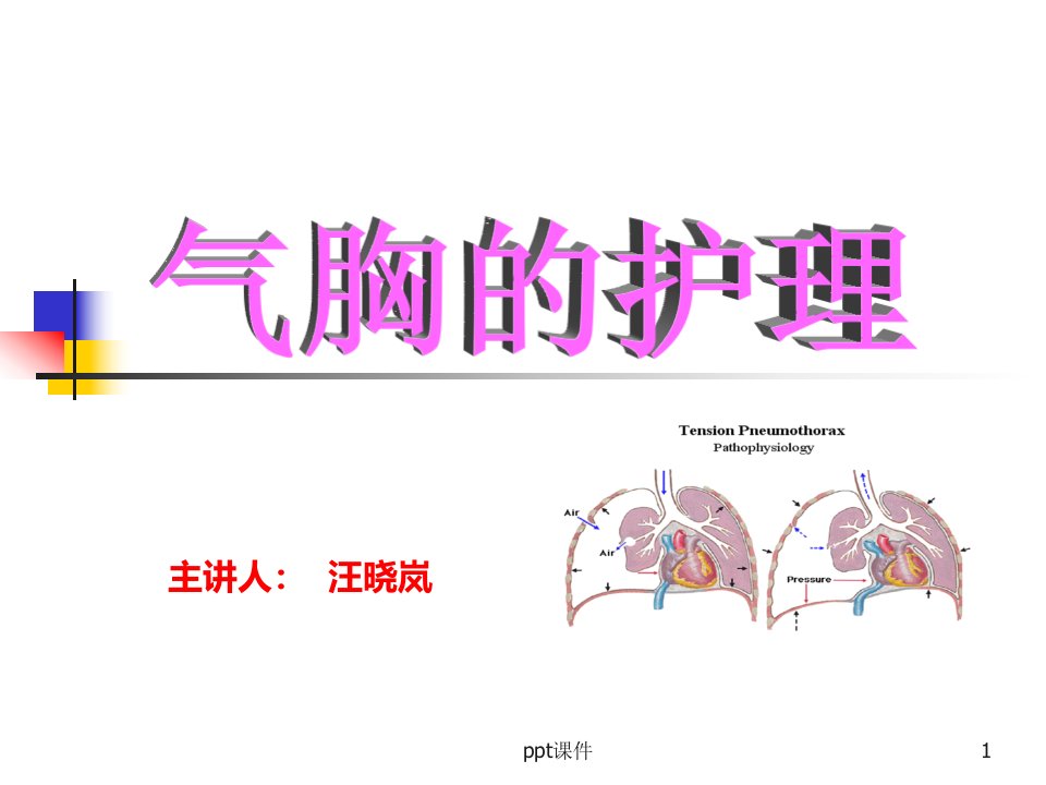 气胸的分类及护理