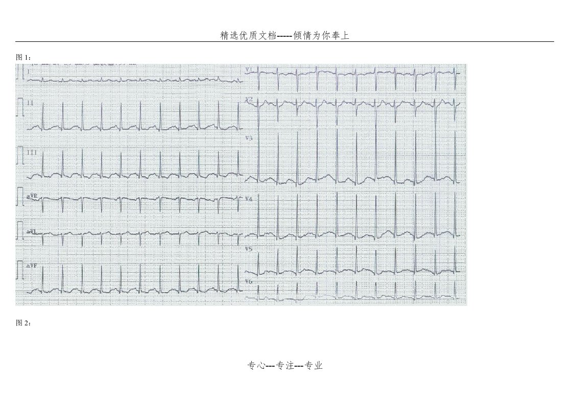 心电图阅图试题14题及答案(共16页)