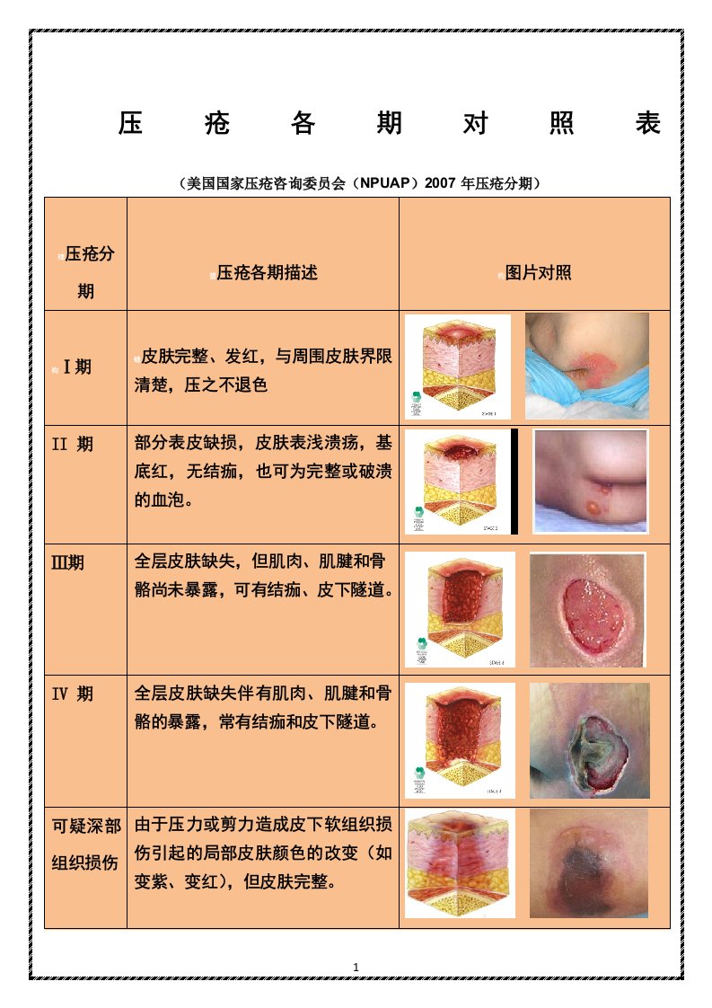 压疮各期对照表(彩图)