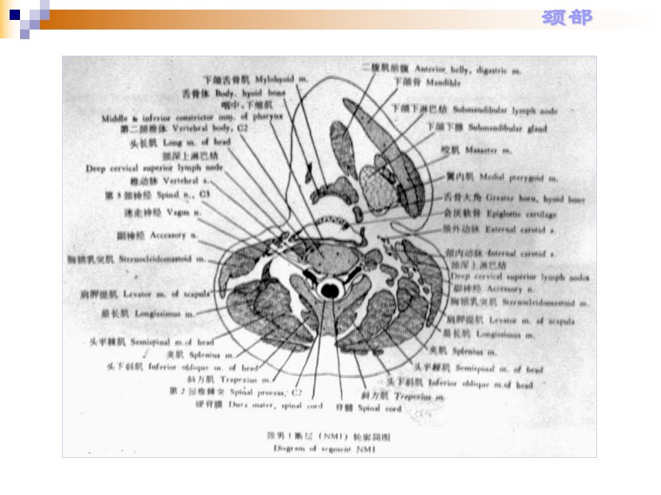 人体解剖断层颈部断面