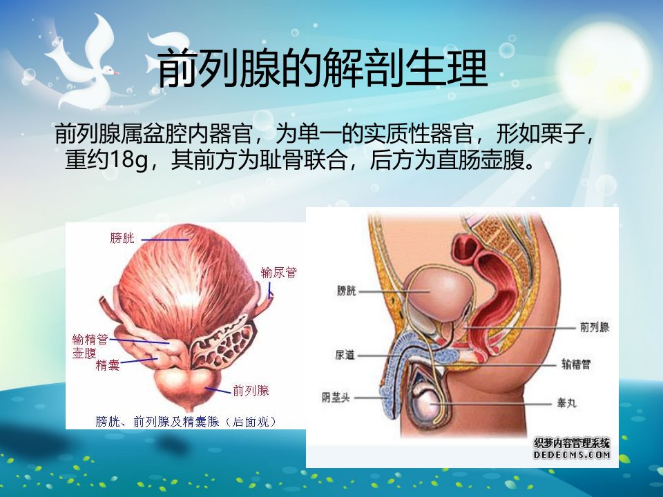 前列腺癌护理ppt课件