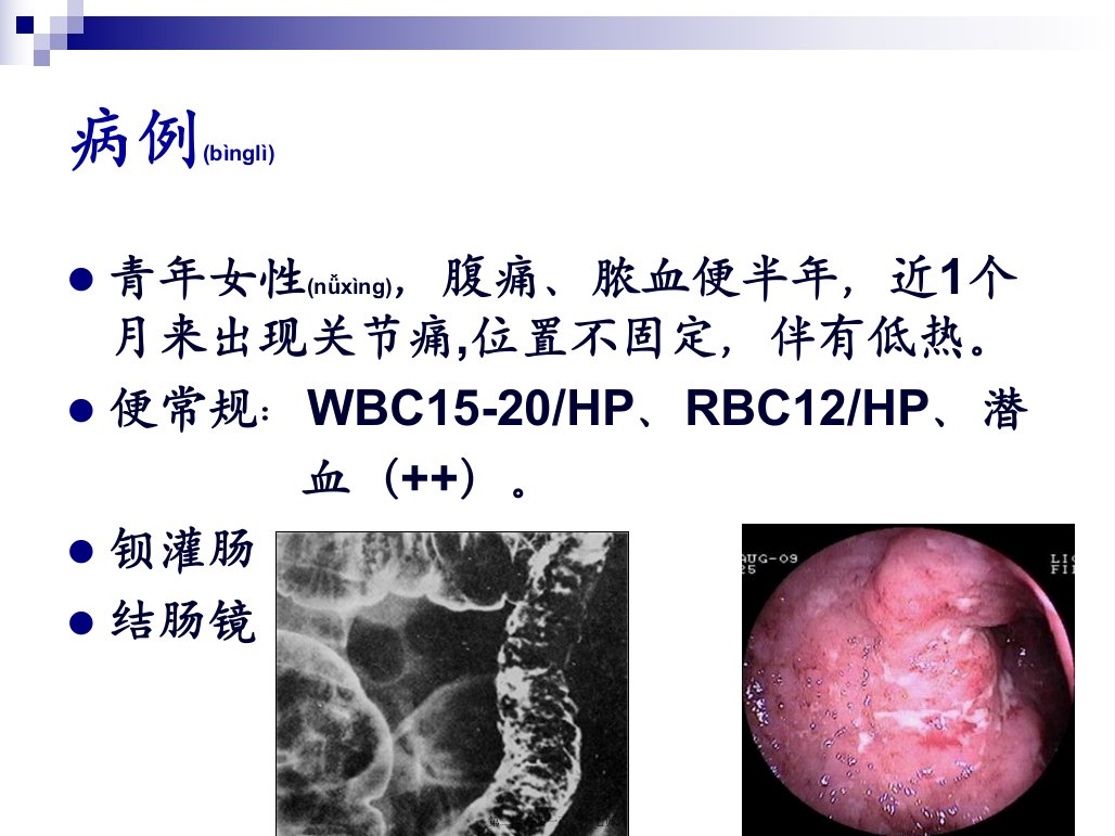 医学专题炎症性肠病.ppt7年制