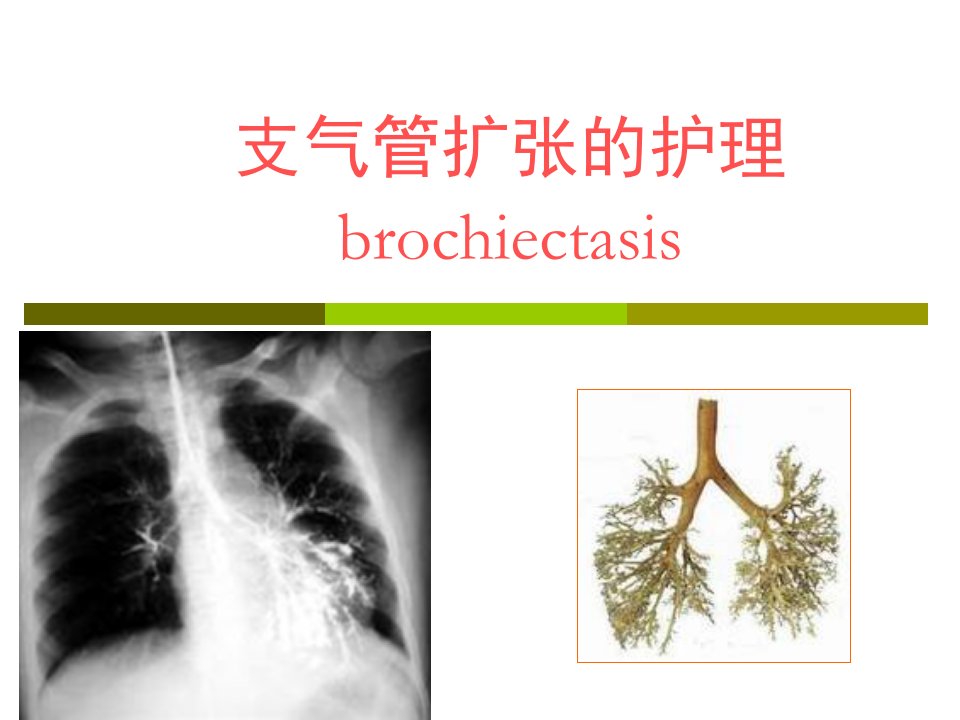 《支气管扩张的护理》PPT课件