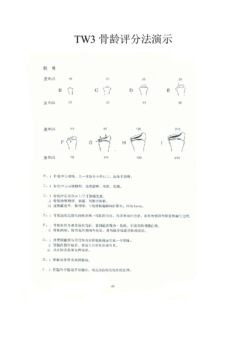 TW3骨龄评分法演示