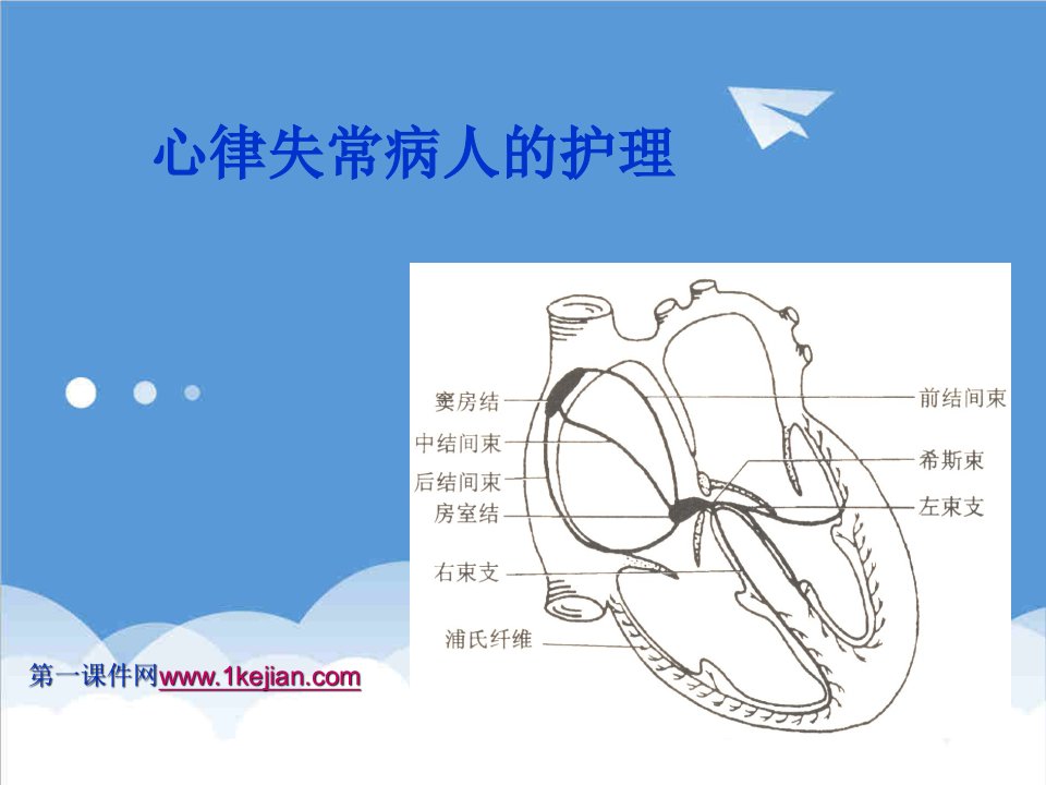 心律失常病人的护理