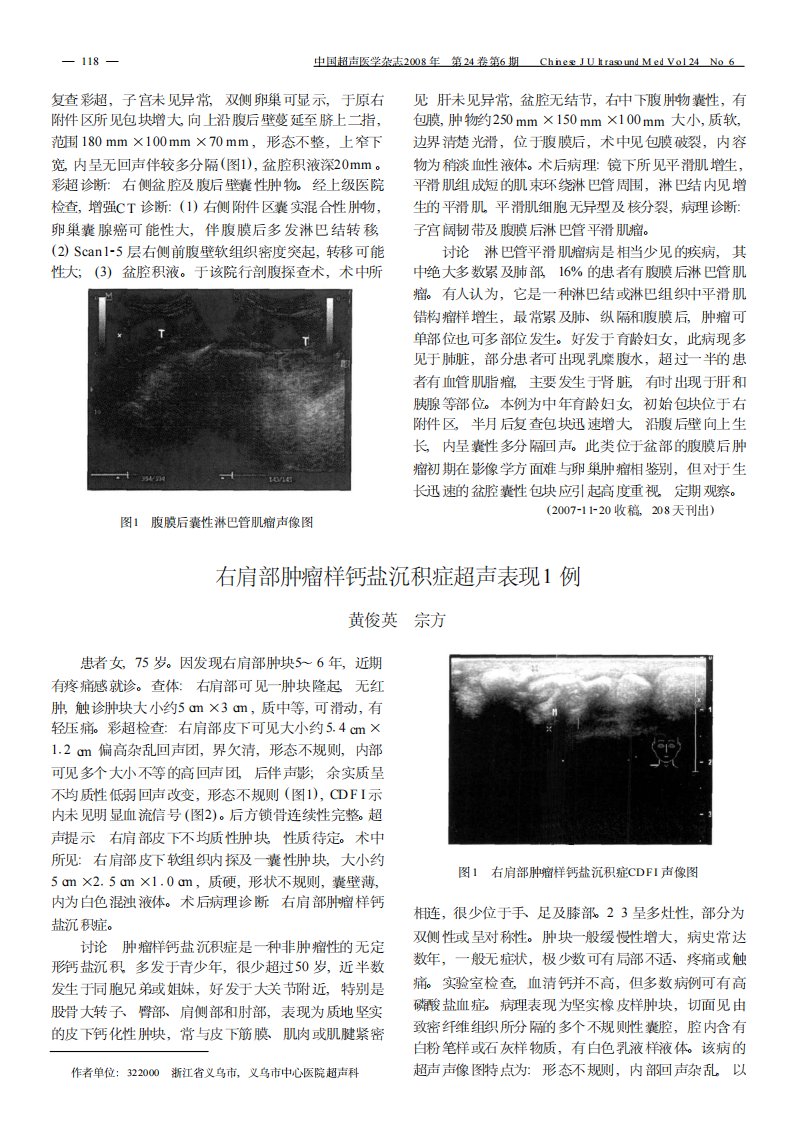 右肩部肿瘤样钙盐沉积症超声表现1例.pdf