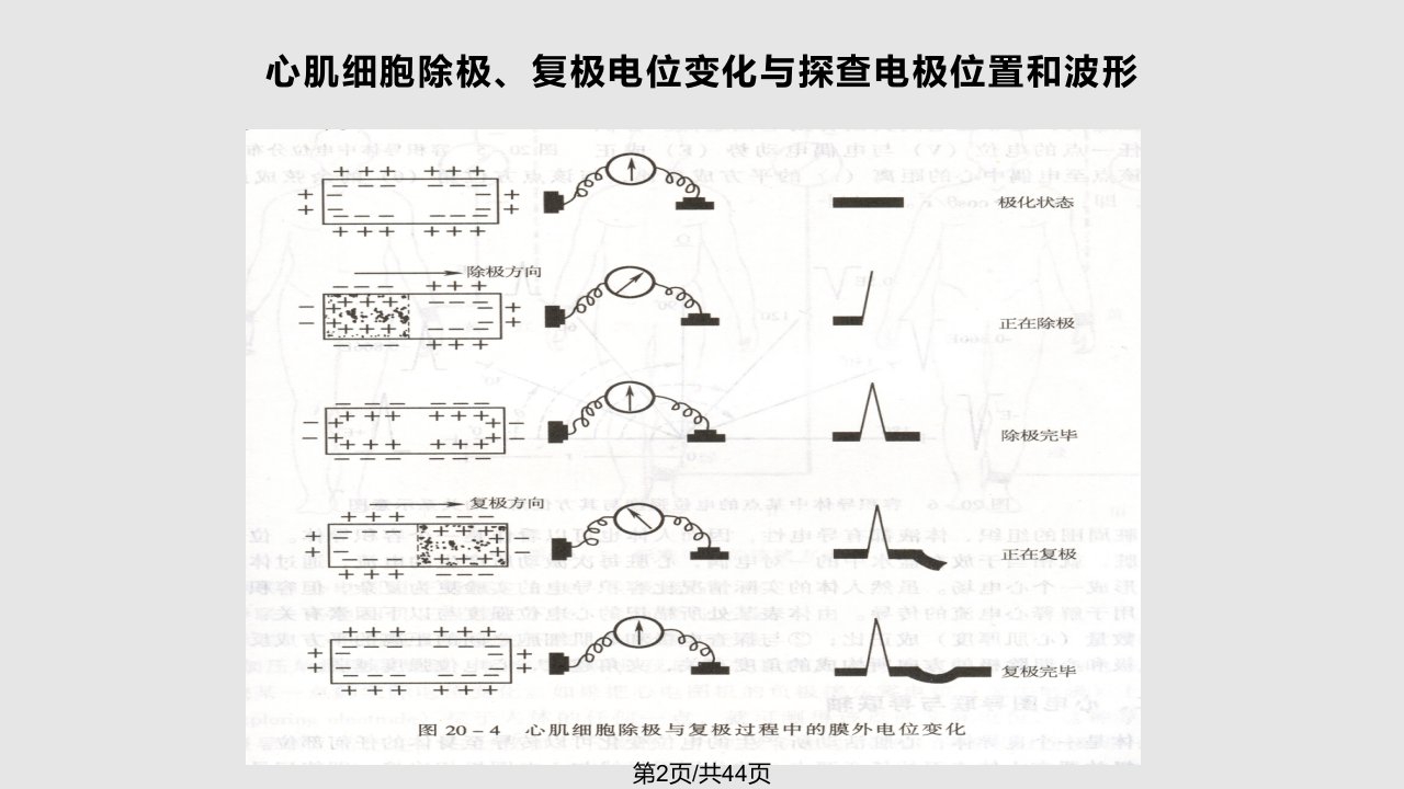 最新资料正常心电图模版